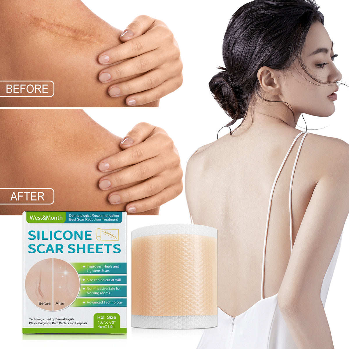 Silicone Scar Tape Roll for C-Section Main image