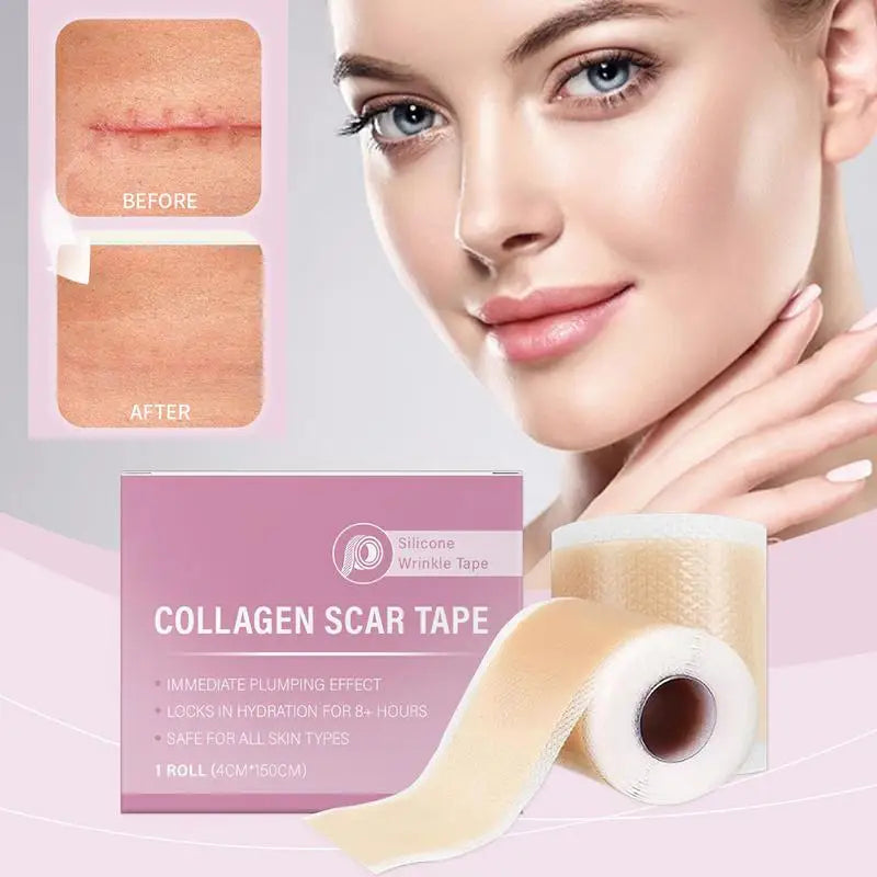 C-section Silicone Scar Strips