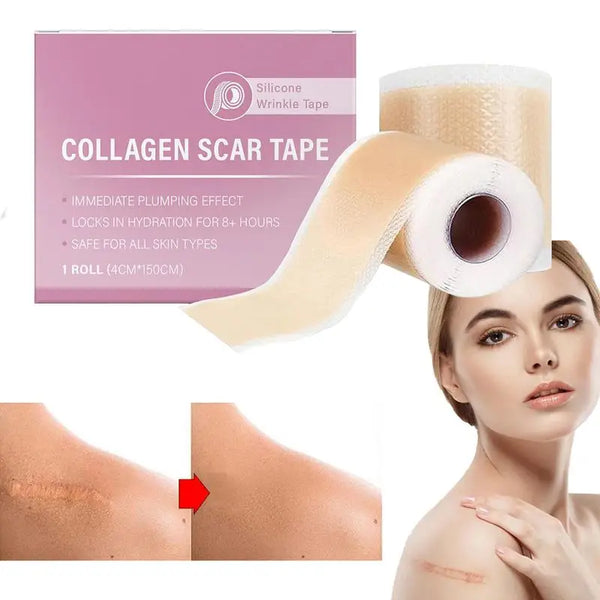 C-section Silicone Scar Strips